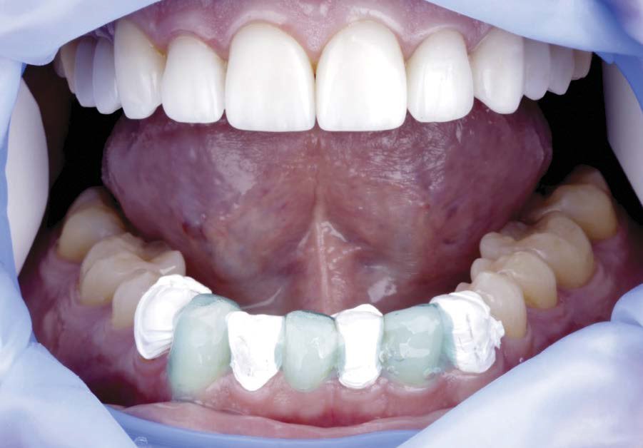 American Academy of Cosmetic Dentistry