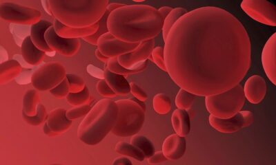 The American Society of Hematology